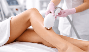 Laser Hair Removal
