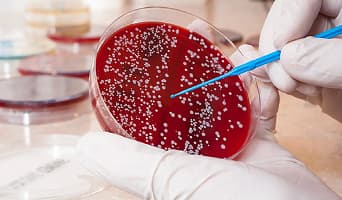 Leukemia