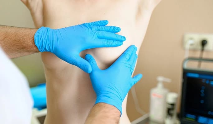Mastectomy