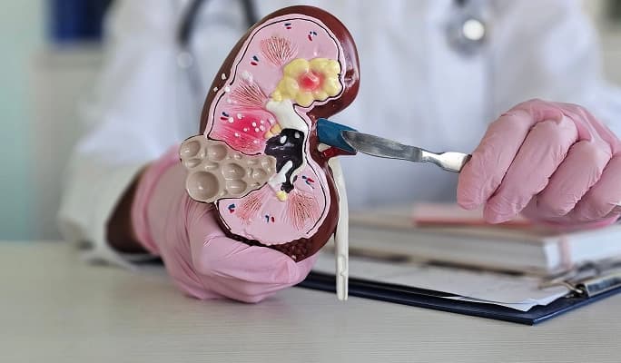 Mini PCNL