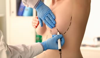 Reduction Mammoplasty