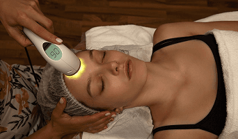 Thermage (Skin Tightening)