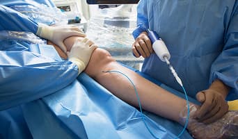 Vascular Surgery