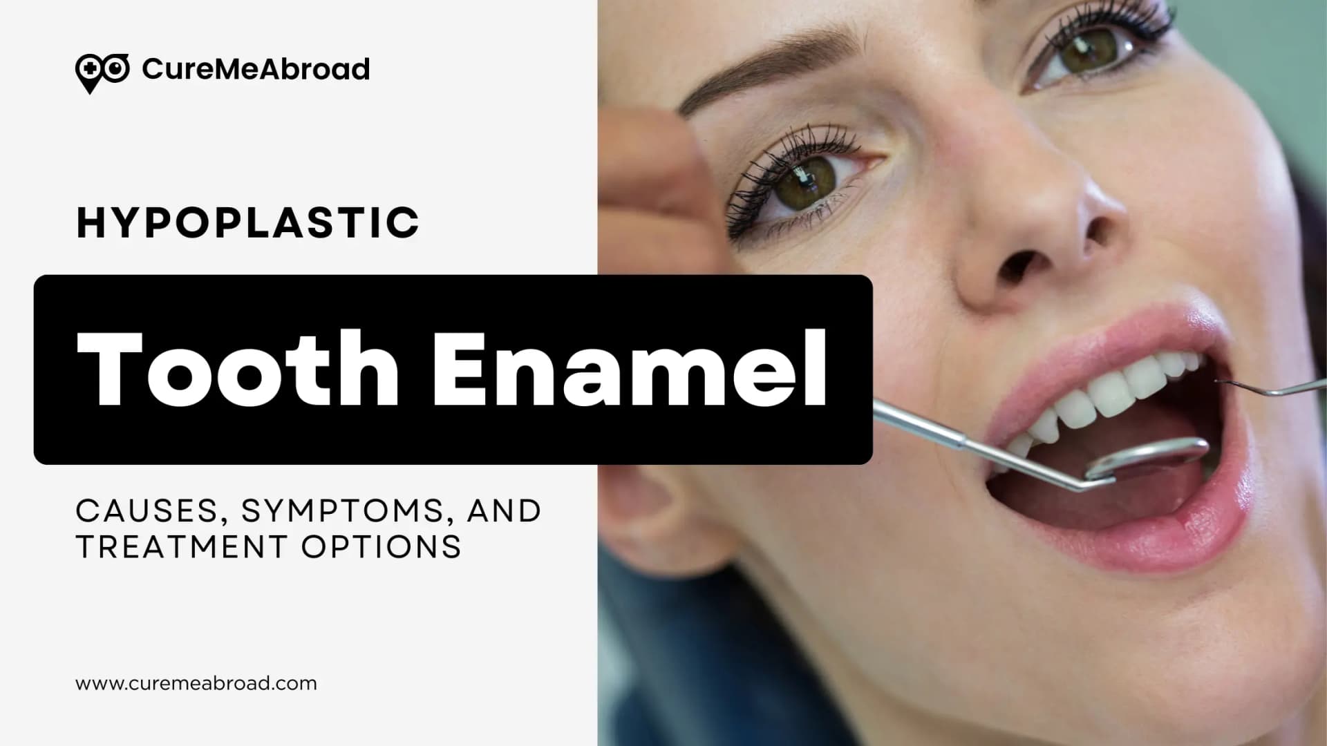 Hypoplastic Tooth Enamel: Causes, Symptoms, and Treatment Options
