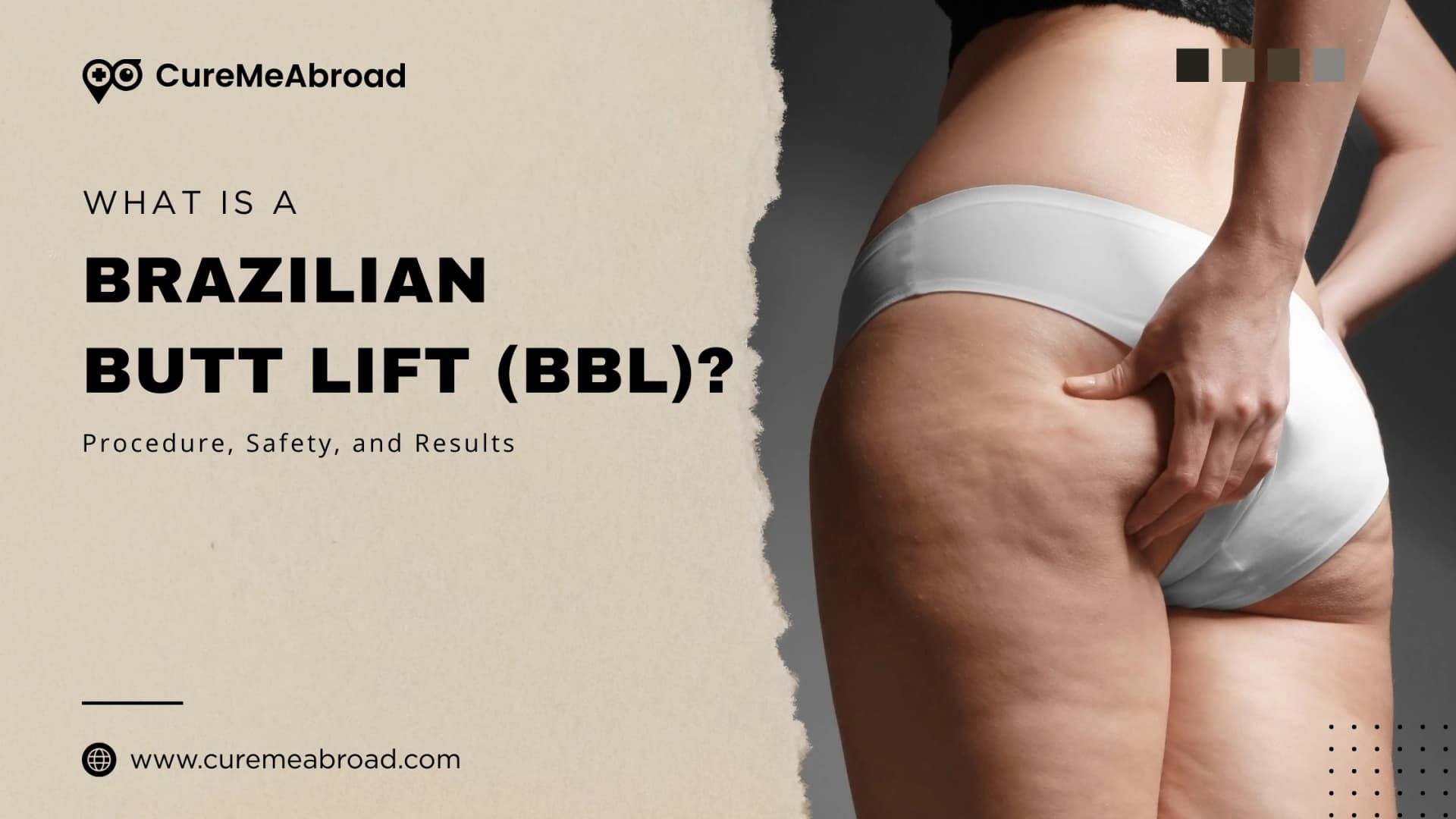 What Is a Brazilian Butt Lift (BBL)? Procedure, Safety, and Results