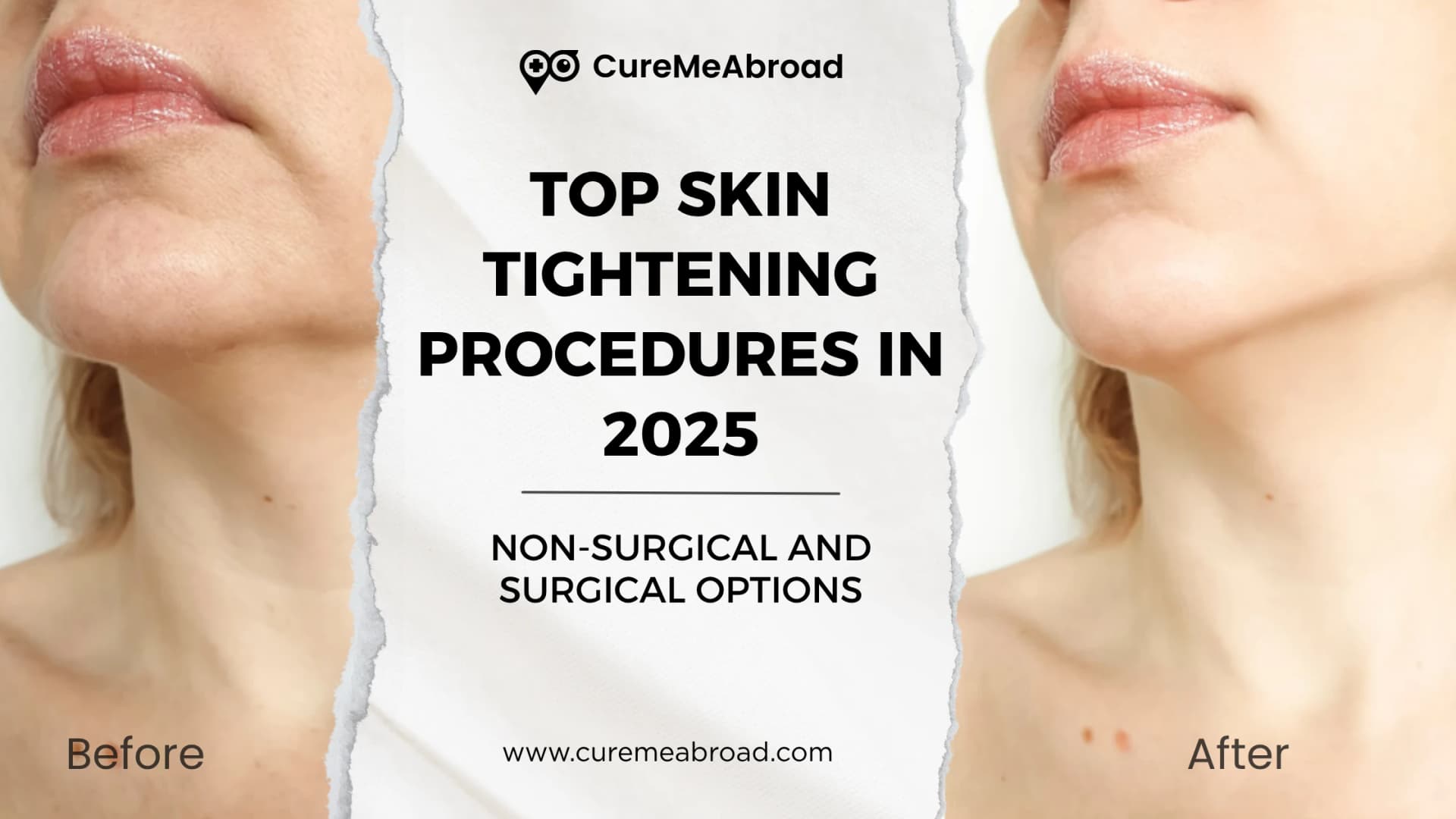 Top Skin Tightening Procedures in 2025: Non-Surgical and Surgical Options  