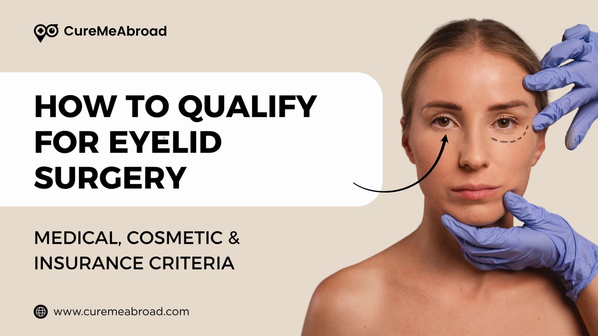 How to Qualify for Eyelid Surgery: Medical, Cosmetic & Insurance Criteria