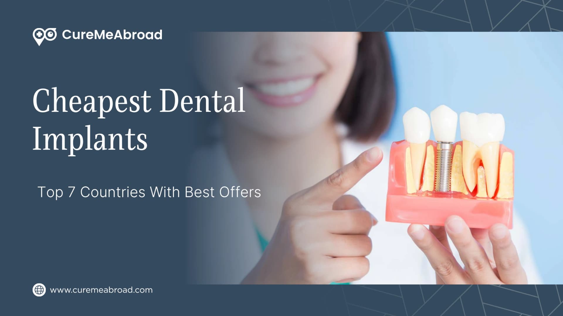 Cheapest Dental Implants: Top 7 Countries With Best Offers