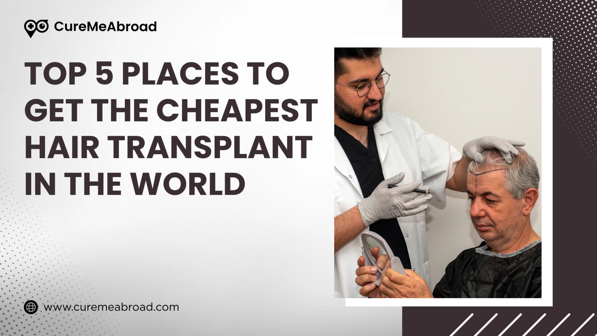 Top 5 Places to Get the Cheapest Hair Transplant in the World