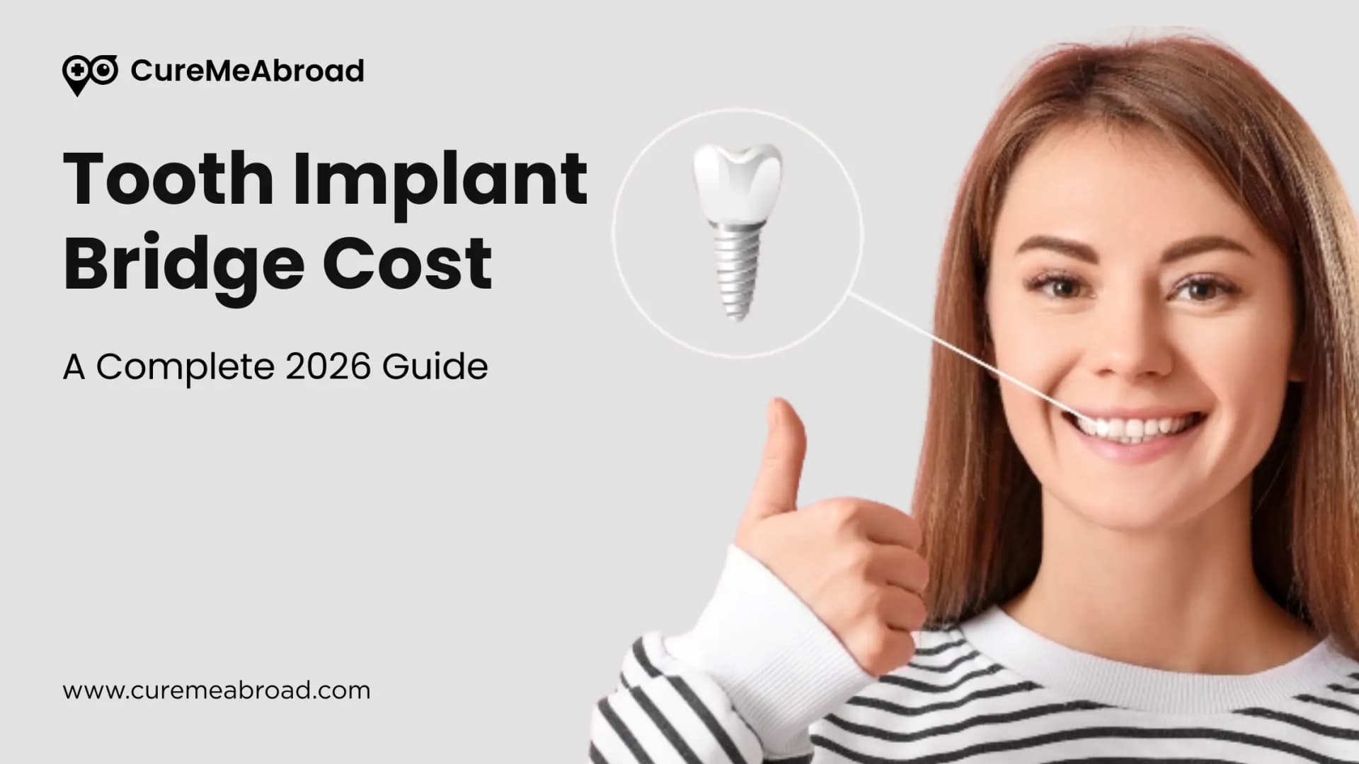 Tooth Implant Bridge Cost: A Complete 2026 Guide