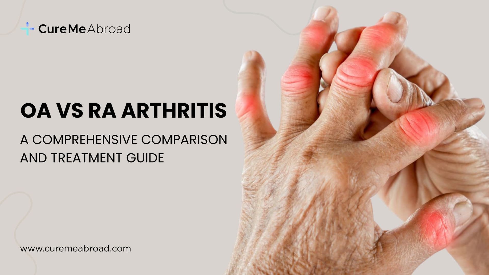 OA vs RA Arthritis: A Comprehensive Comparison and Treatment Guide