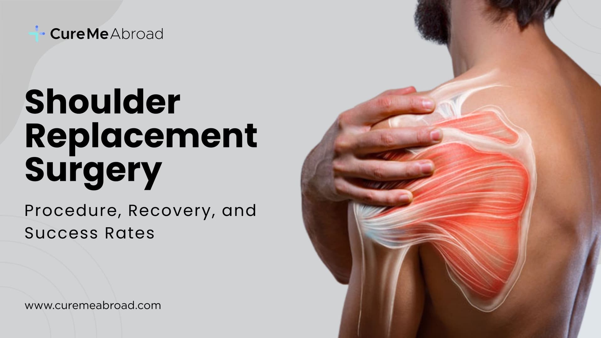 Shoulder Replacement Surgery: Procedure, Recovery, and Success Rates