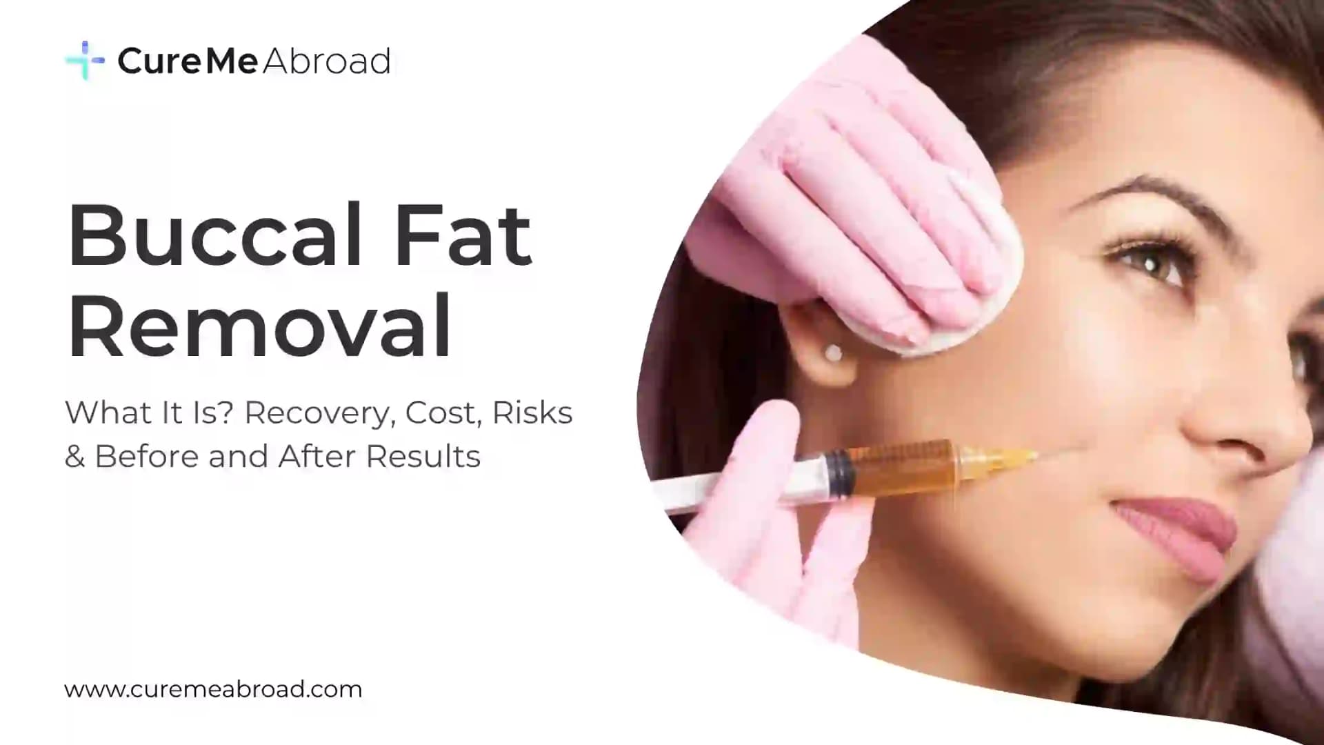 Buccal Fat Removal: Cost, Recovery, Risks & Before After Results (2026 Guide)
