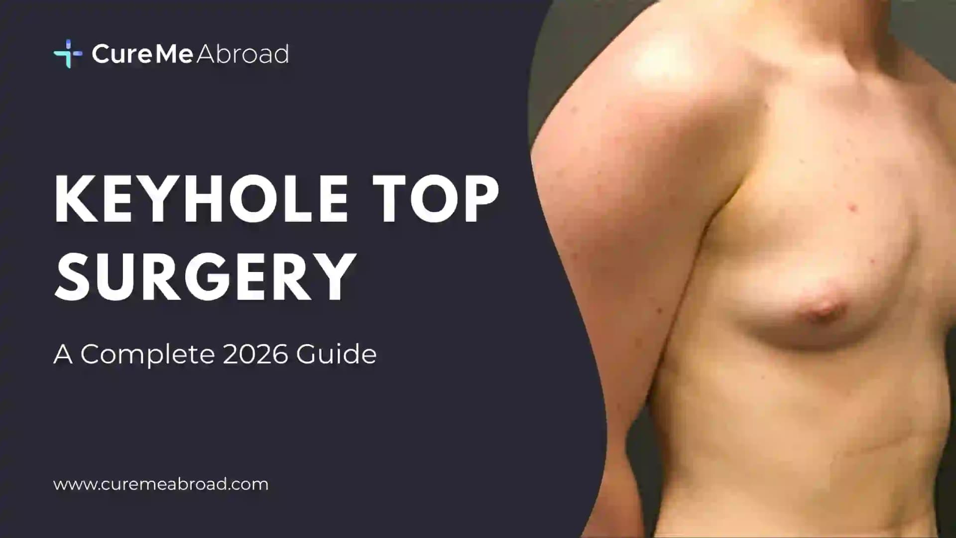 Keyhole Top Surgery: A Complete 2026 Guide
