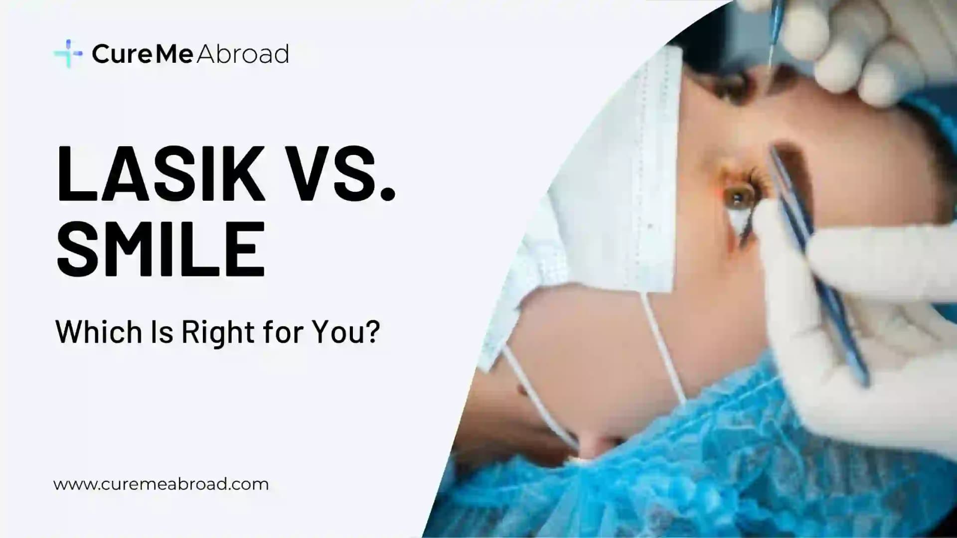 LASIK vs. SMILE: Which Is Right for You in 2026?