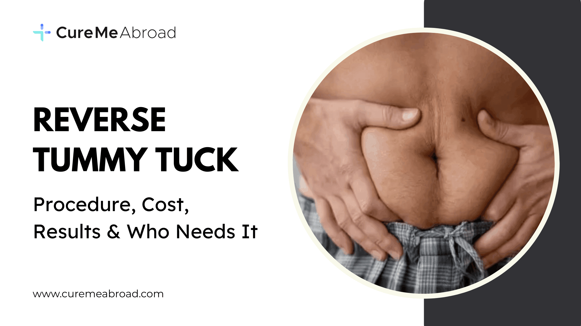 Reverse Tummy Tuck: Procedure, Cost, Results & Who Needs It 