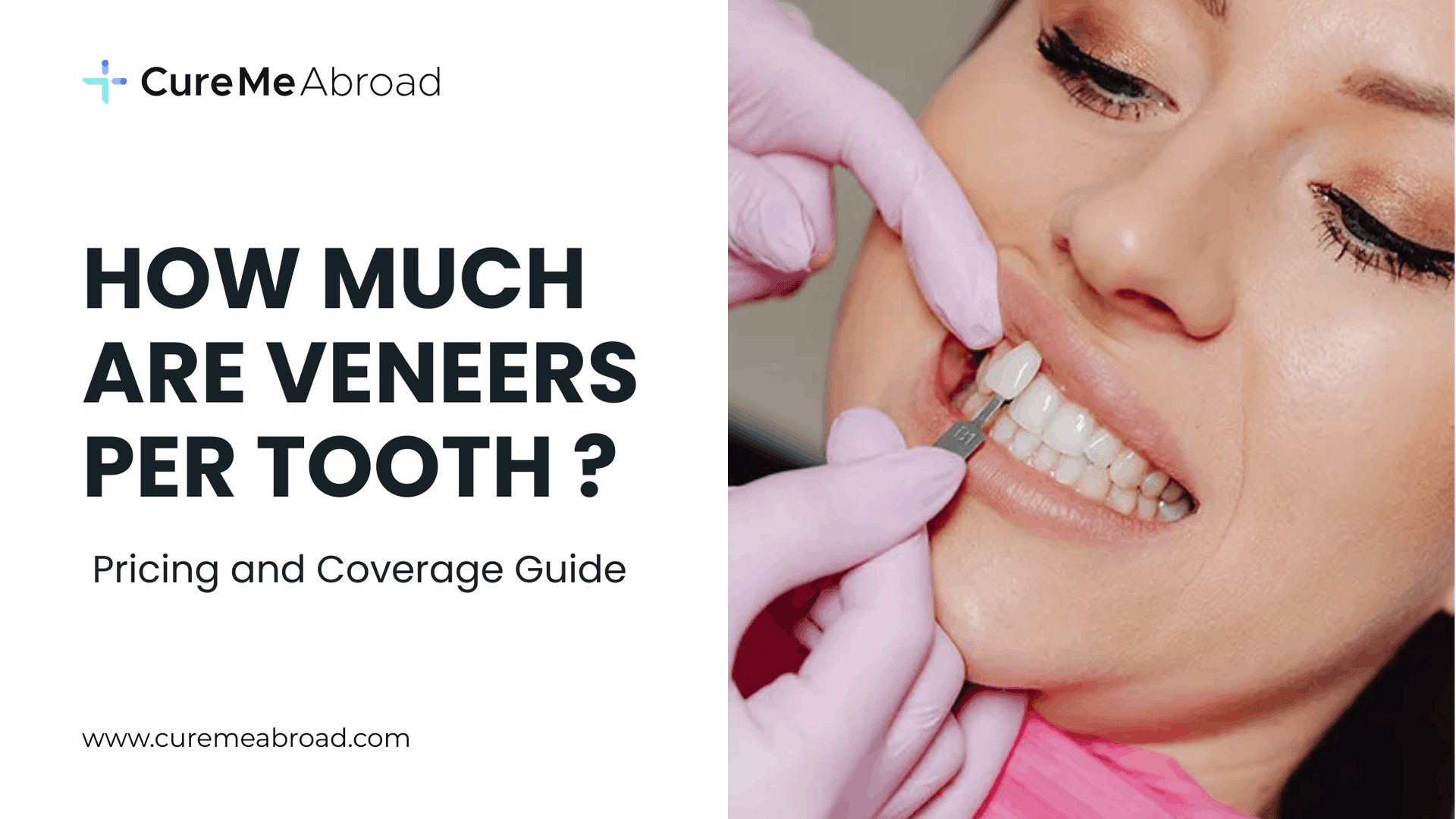 How Much Are Veneers Per Tooth? Pricing and Coverage Guide (2026)