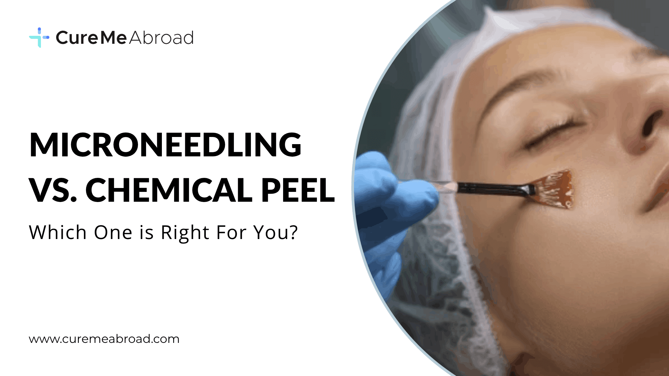 Microneedling vs. Chemical Peel: Which One Is Right for You?