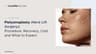 Platysmaplasty (Neck Lift Surgery): Procedure, Recovery, Cost, and What to Expect