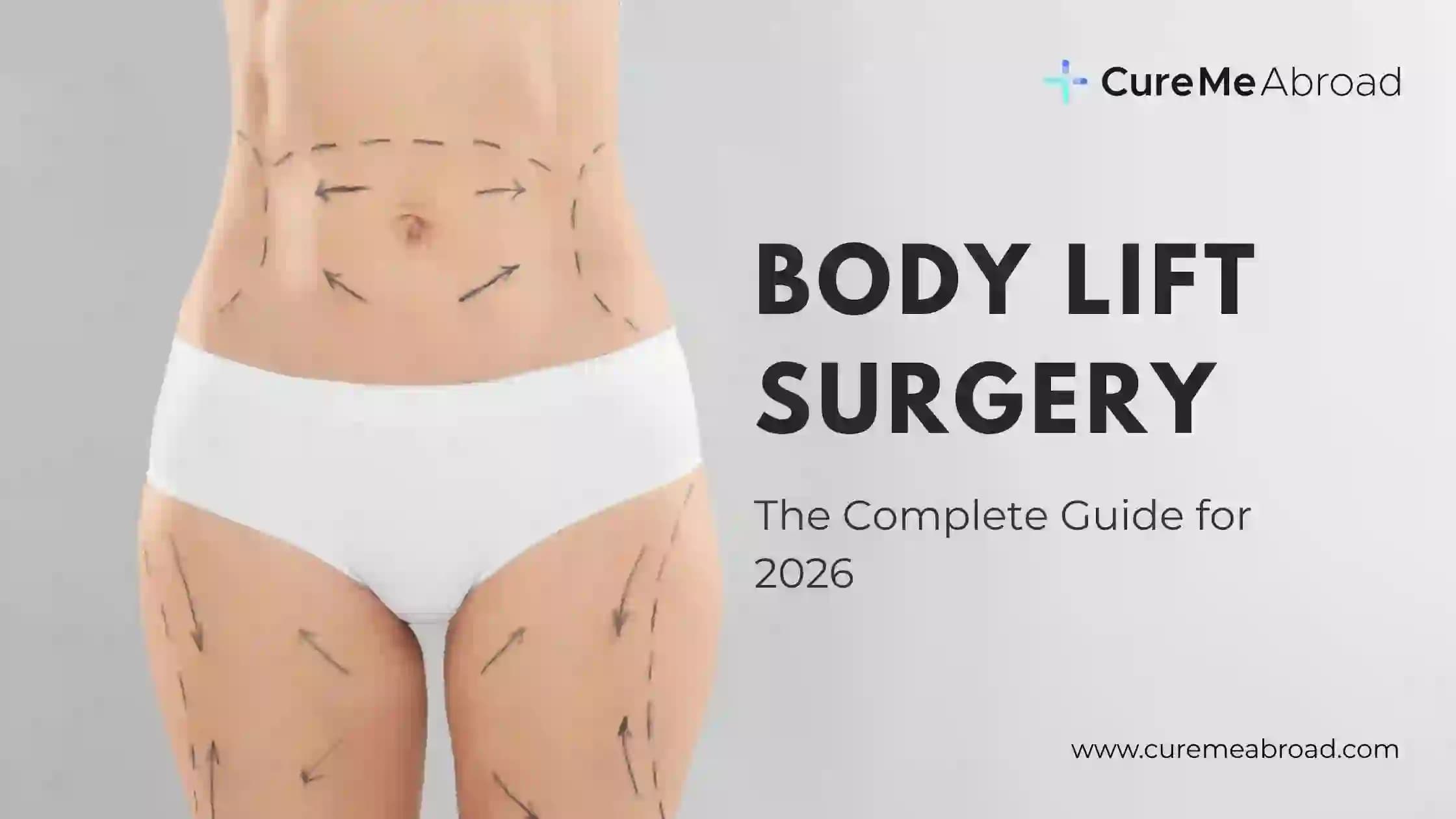 Body Lift Surgery: The Complete Guide for 2026 