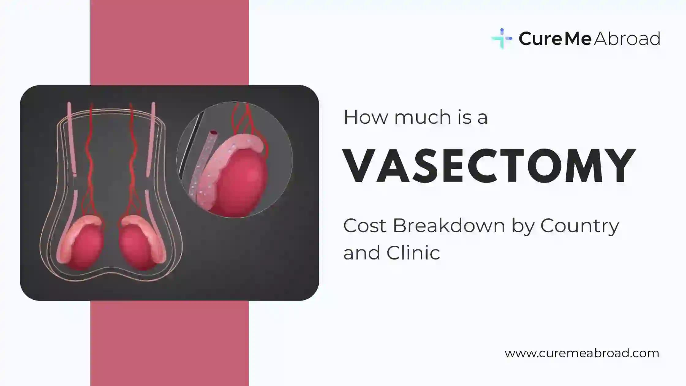 How Much Is a Vasectomy? Cost Breakdown by Country and Clinic