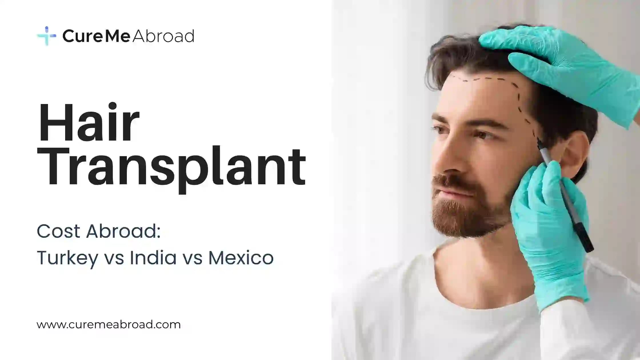 Hair Transplant Cost Abroad: Turkey vs India vs Mexico