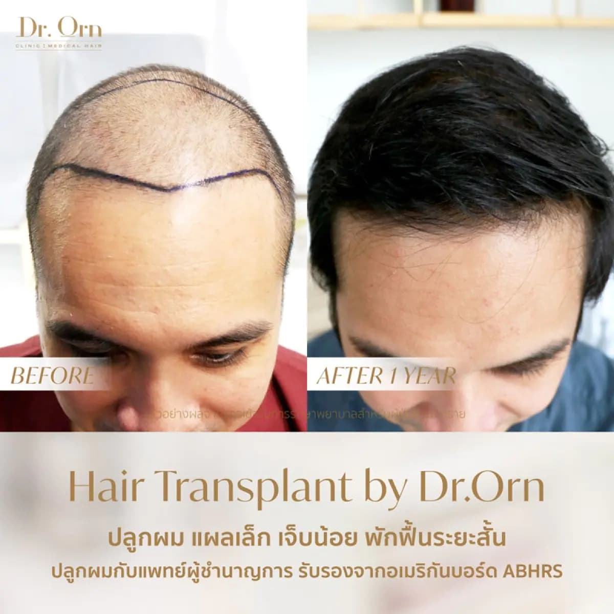 Dr.Orn Clinic : Medical Hair - Image 3