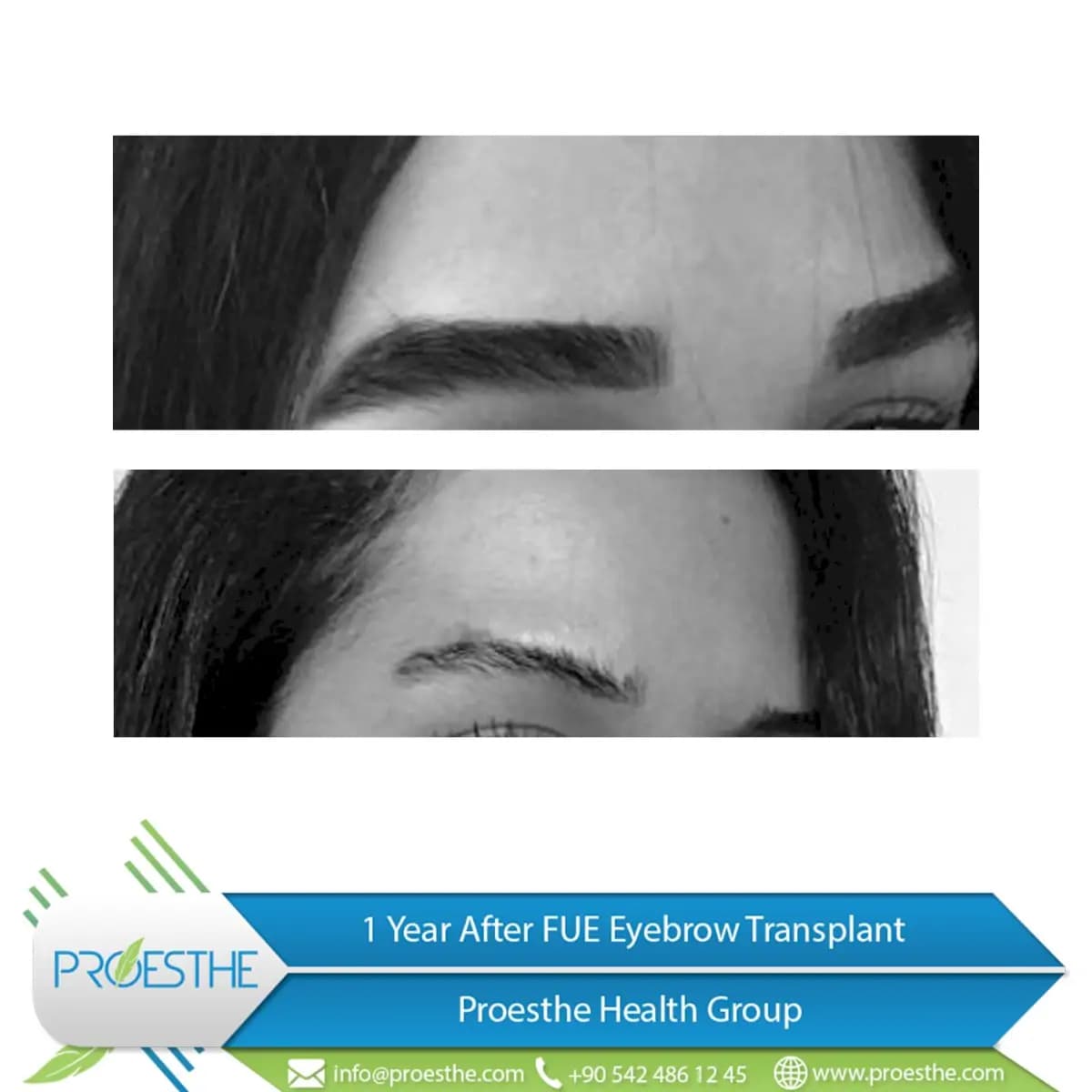 Proesthe Hair Transplant Center - Image 3