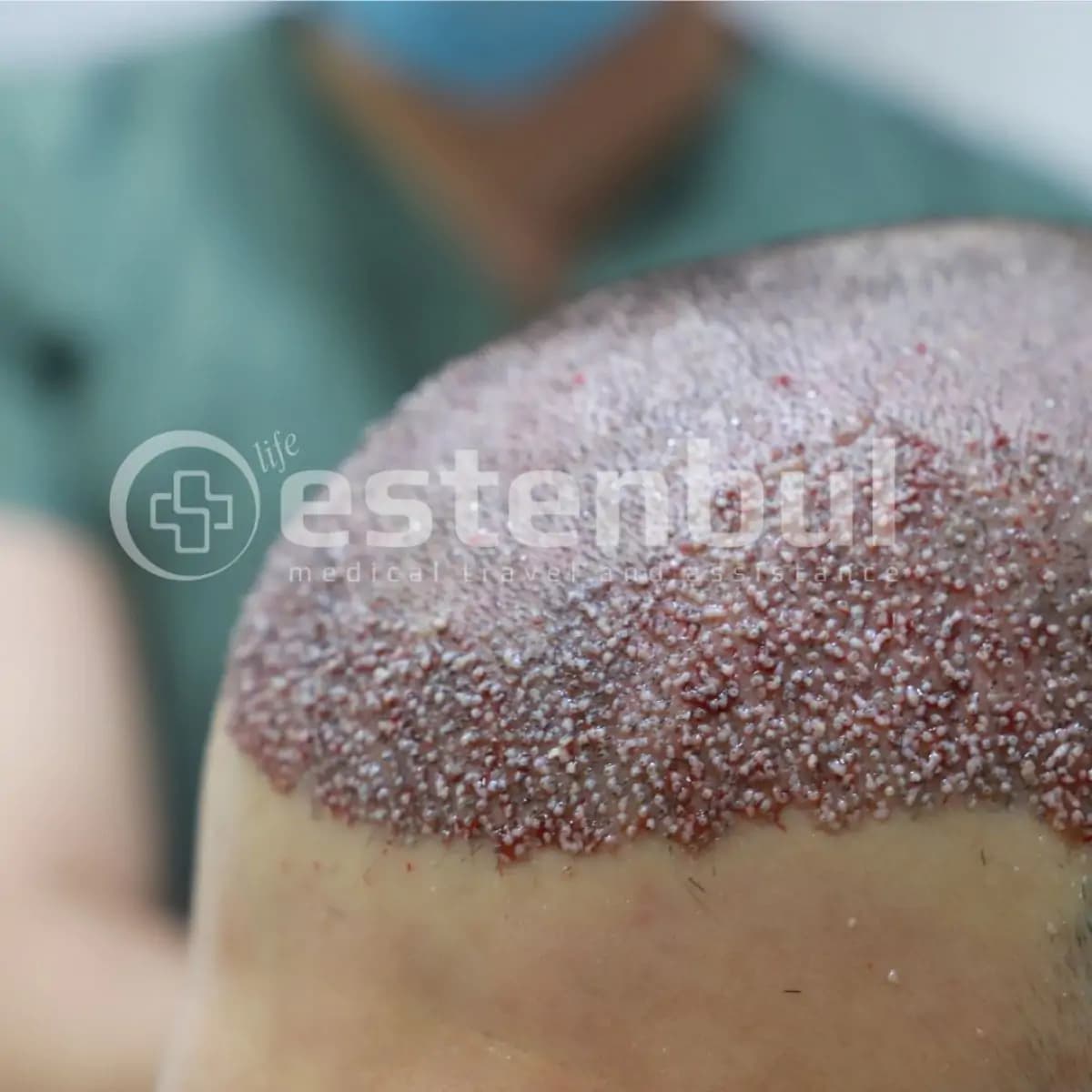 Estenbul Health - Image 3