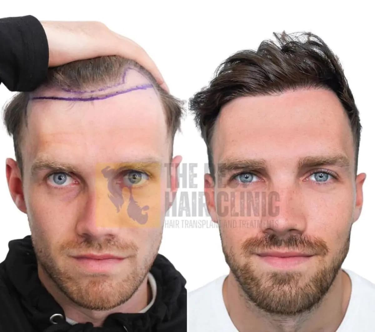 The Best Hair Clinic - Image 2