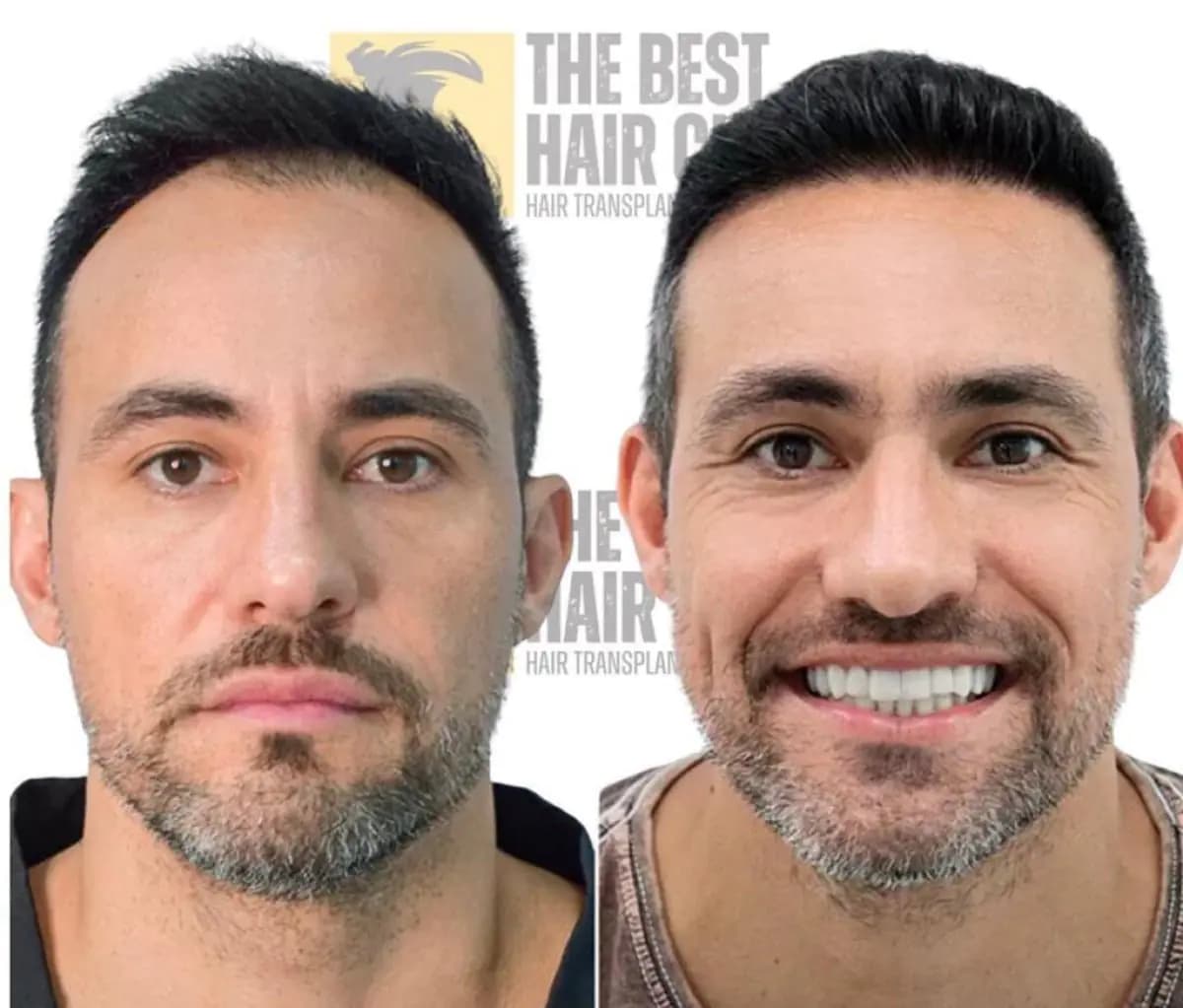 The Best Hair Clinic - Image 3