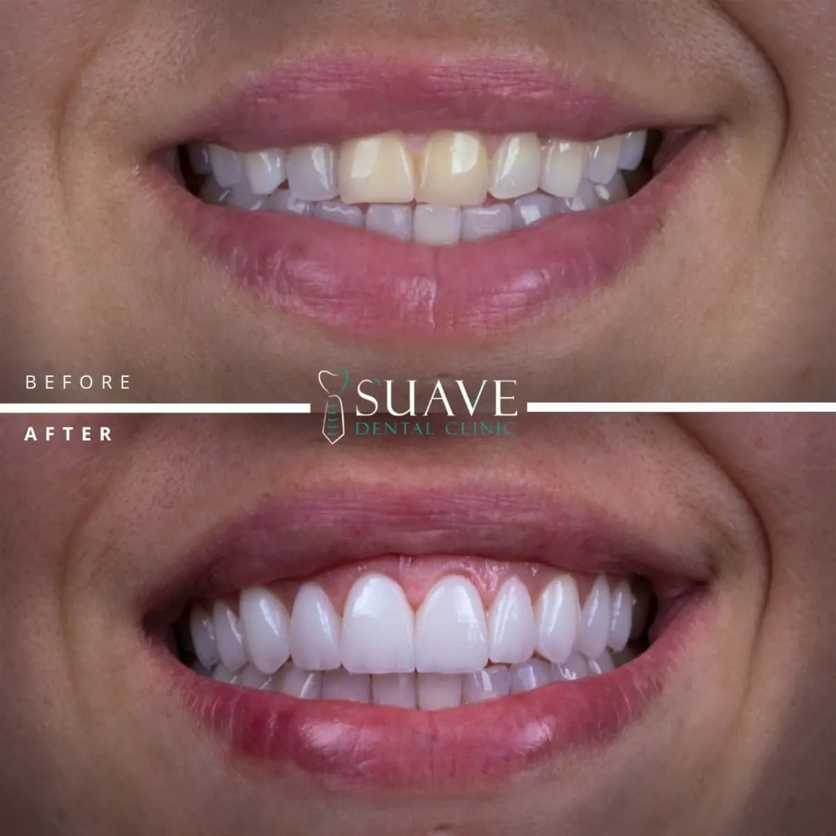SUAVE DENTAL CLINIC - Image 3