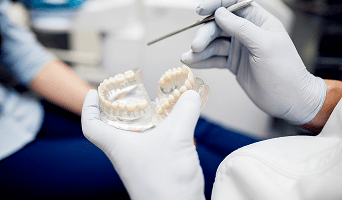 All on 6 Dental Implants
