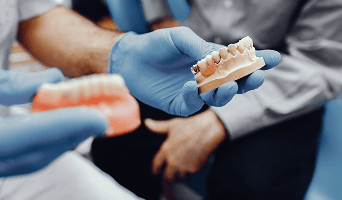 All on 8 Dental Implants