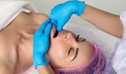 Bichectomy (Buccal Fat Removal)