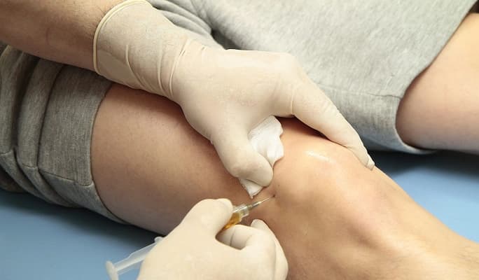 Cartilage Regeneration Stem Cell Therapy