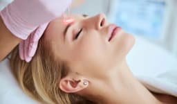 CO2 Laser Resurfacing