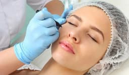 Fox Eye Surgery / Canthoplasty