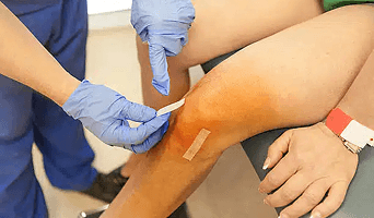 Knee Replacement Surgery