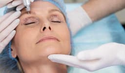 Lower Eyelid Surgery