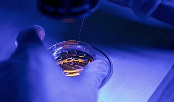 Preimplantation Genetic Diagnosis (PGD)