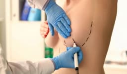 Reduction Mammoplasty