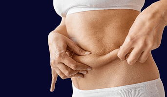 Roux en Y Gastric Bypass