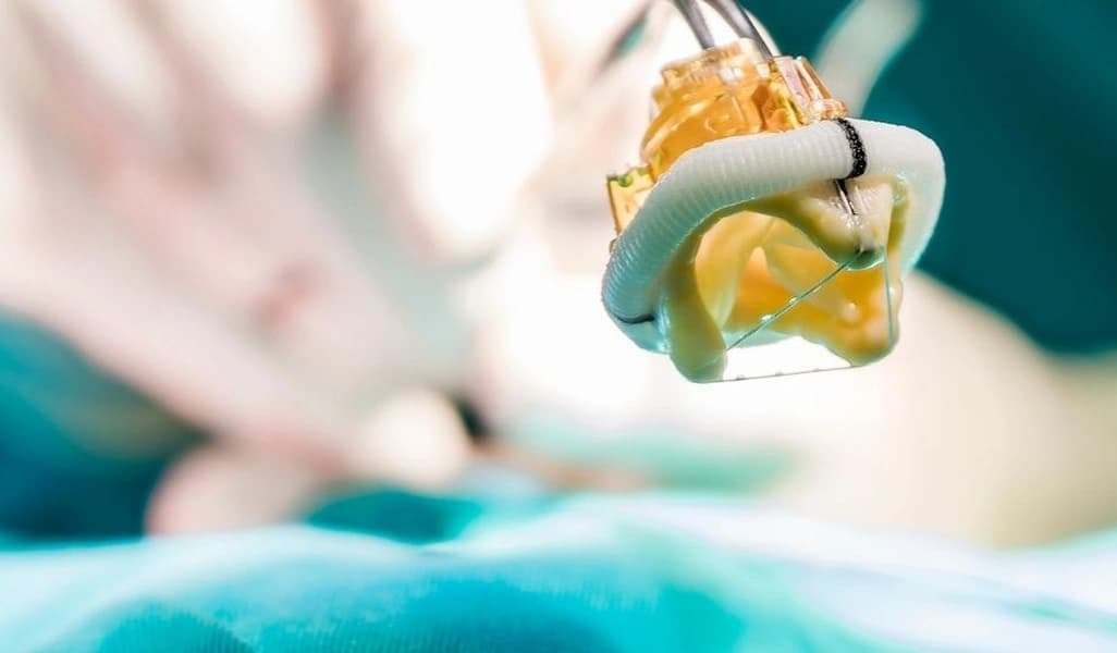 TAVR / TAVI Heart Valve Replacement