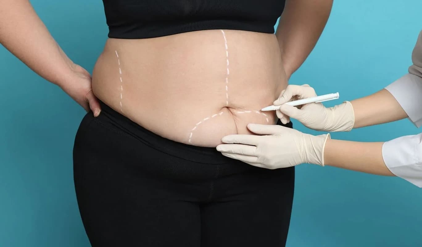 Obesity/Bariatric Surgery