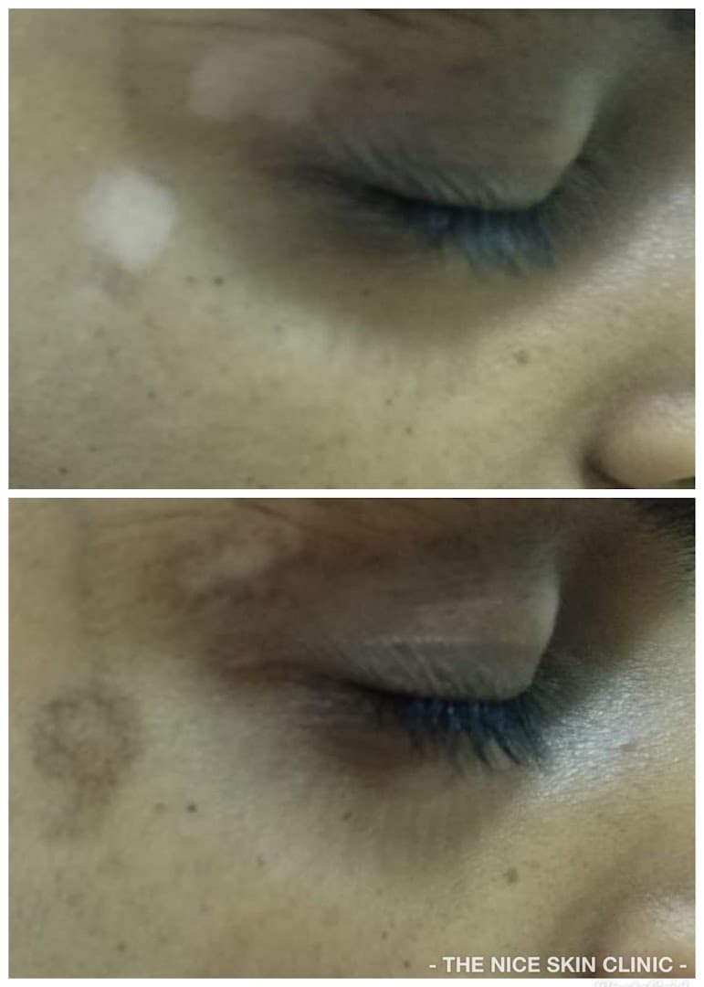 The Cosmetic Skin Clinic - Anti Wrinkle - Image 3