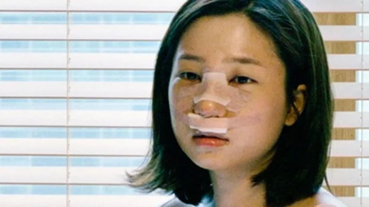 Cosmetic Surgery Thailand - Image 4