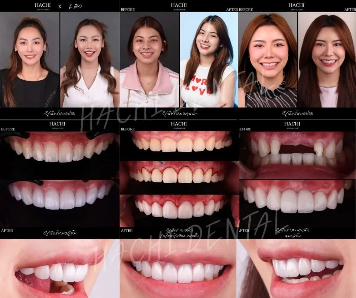 Hachi Dental Clinic & Digital Veneer Lab - Image 4