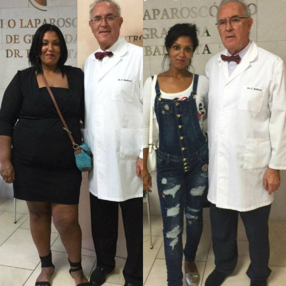 gastric band