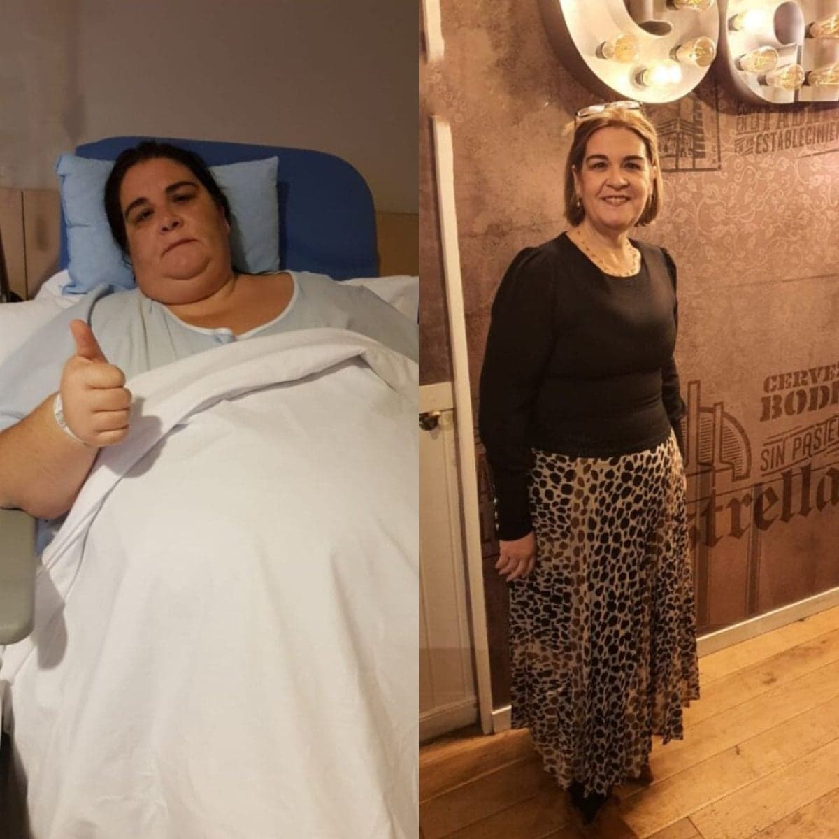 gastric band